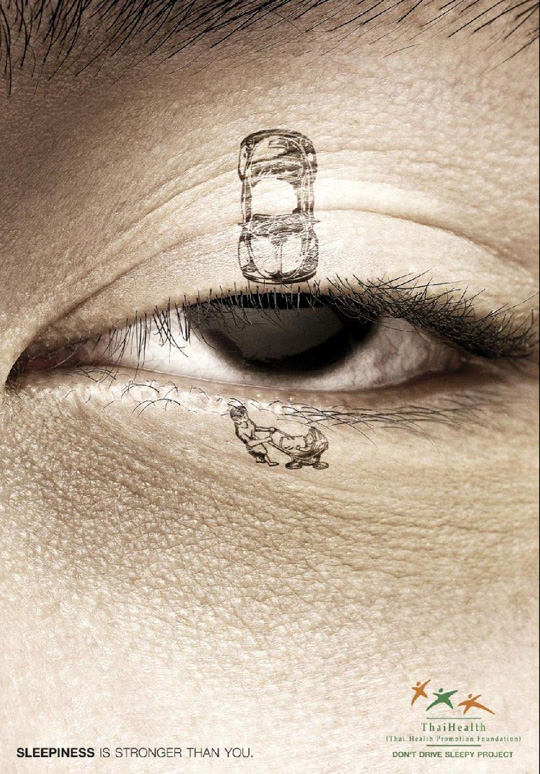 Print Ad - Droopy Eye Accident